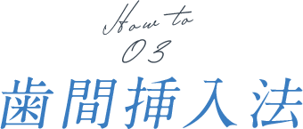 歯間挿入法