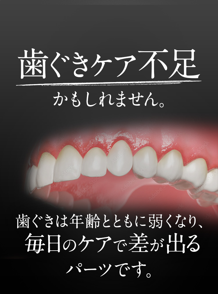 歯ぐきケア不足かもしれません